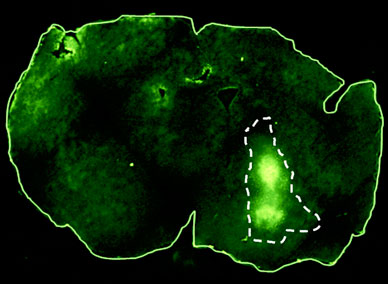Micrograph with outlined tumor for test of blood-brain barrier integrity in mouse pretreated with placebo plus injection of flourescein